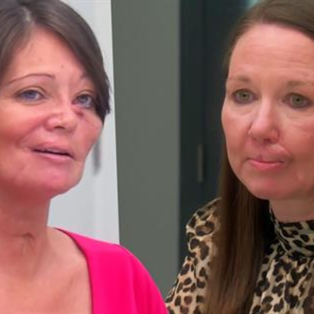 12 Minutes Of Unbelievable Botched Transformations 12 Minutes Of Unbelievable Botched Transformations